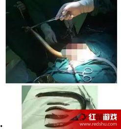 黄鳝女主播2 magnet,磁力链接背后的激情故事揭秘